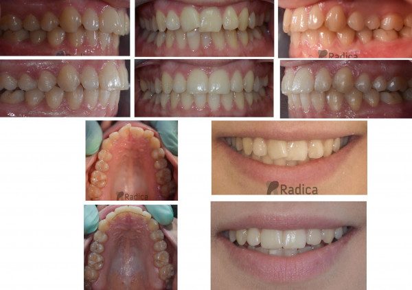 05aparticzazubeortodontradicasplit 600x422 1767732536319 934907907