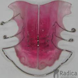 mobilni aparat ploca ortodont radica split 1770205512774 342547422