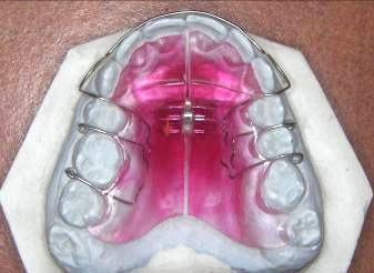 ortodoncija01 1767544601487 100455895