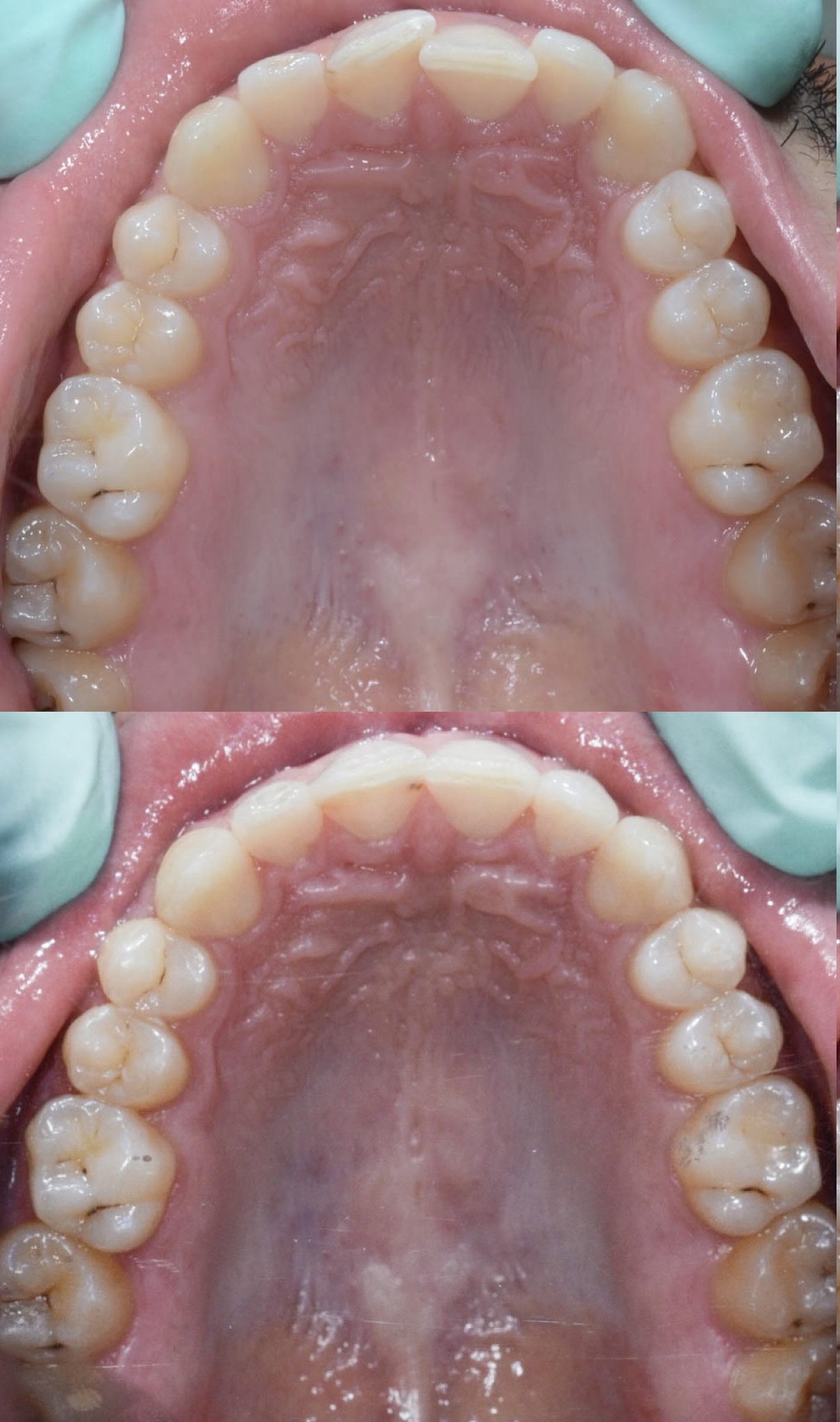 ortodont natasa radica invisalign nevidljivi aparatic za zube 1772053230006 266023627 1773823103710 833767854
