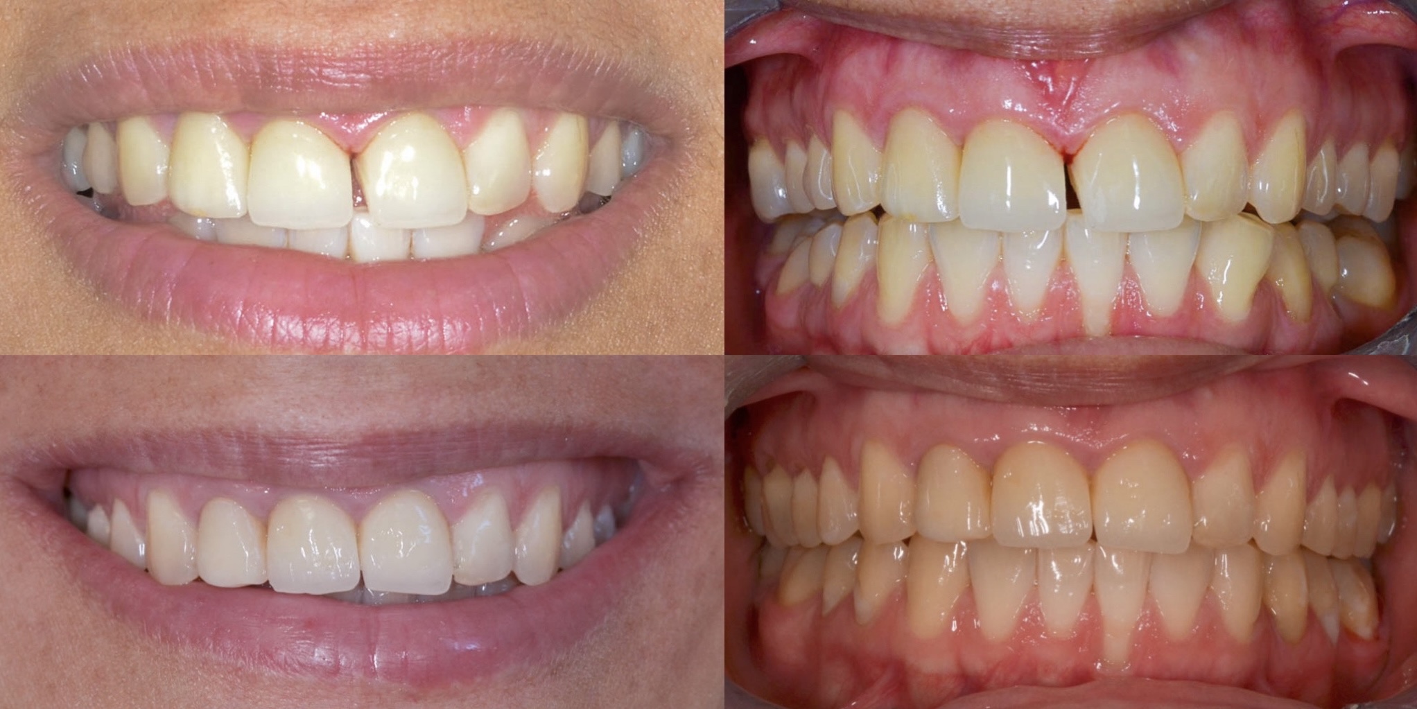 ortodont natasa radica invisalign udalge za zube 1772053480998 884180573