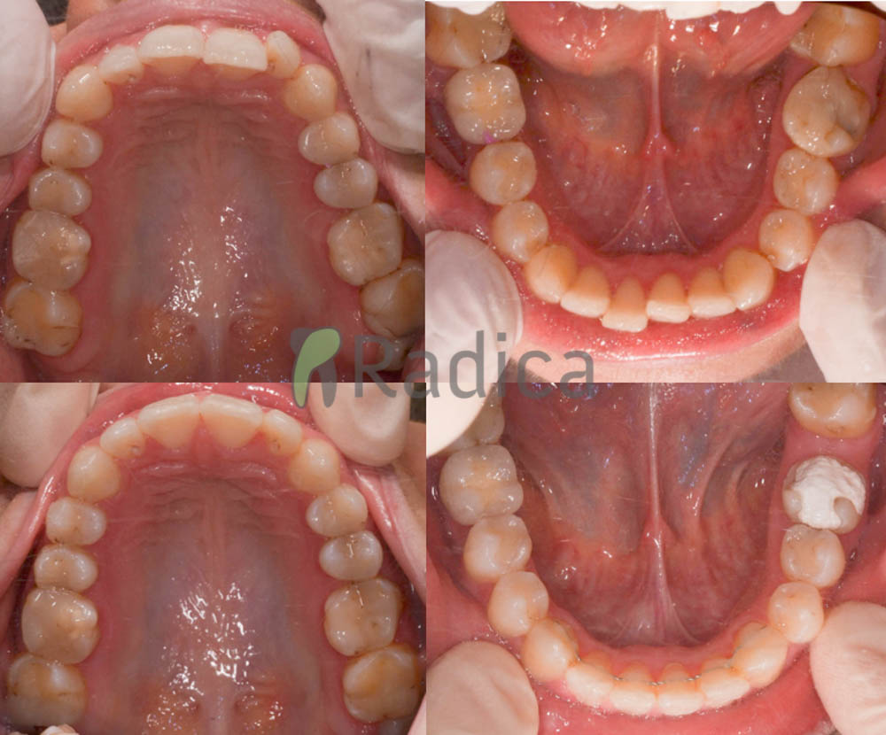 ortodont radica odrasli fiksni aparat 1774463438715 92848909