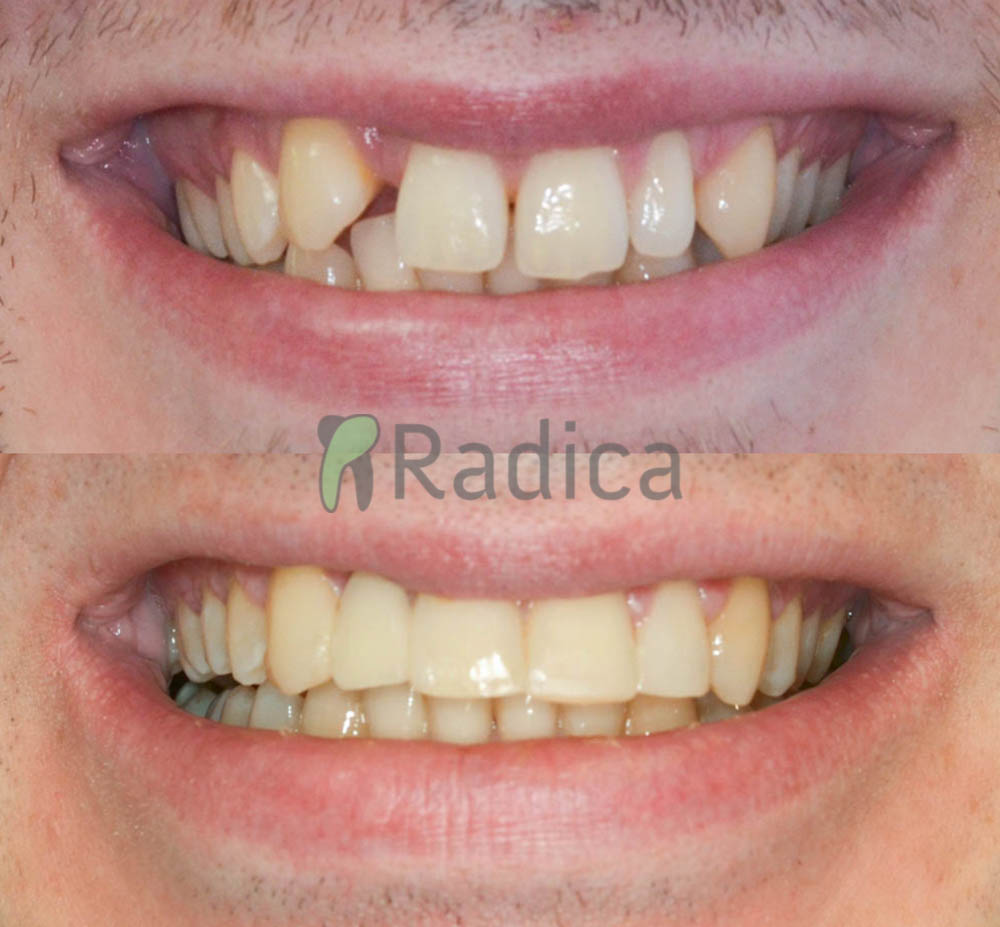 ortodont radica predprotetska ortodoncija 1774374115715 944818108