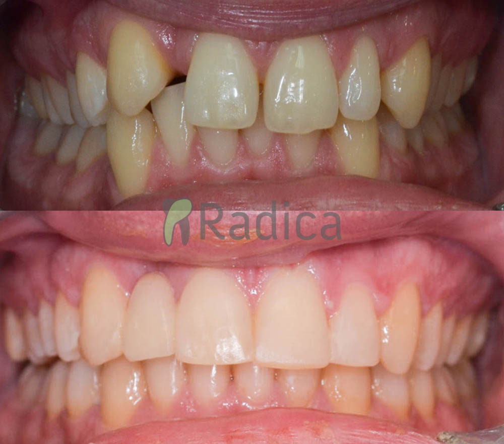 ortodont split hipodoncija 1774374125944 75331983