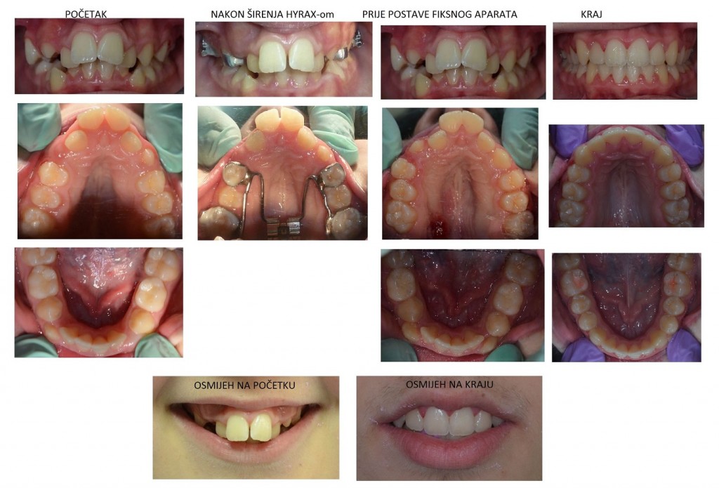 ortodontradicaaparatzairenjenepca 1024x695 1 1767819579244 346916531