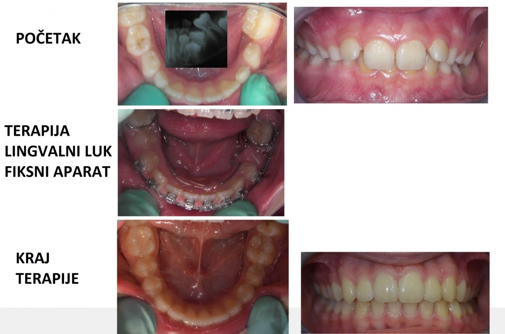 ortodontradicalingvalniluk 1024x677 1767737373670 856626787