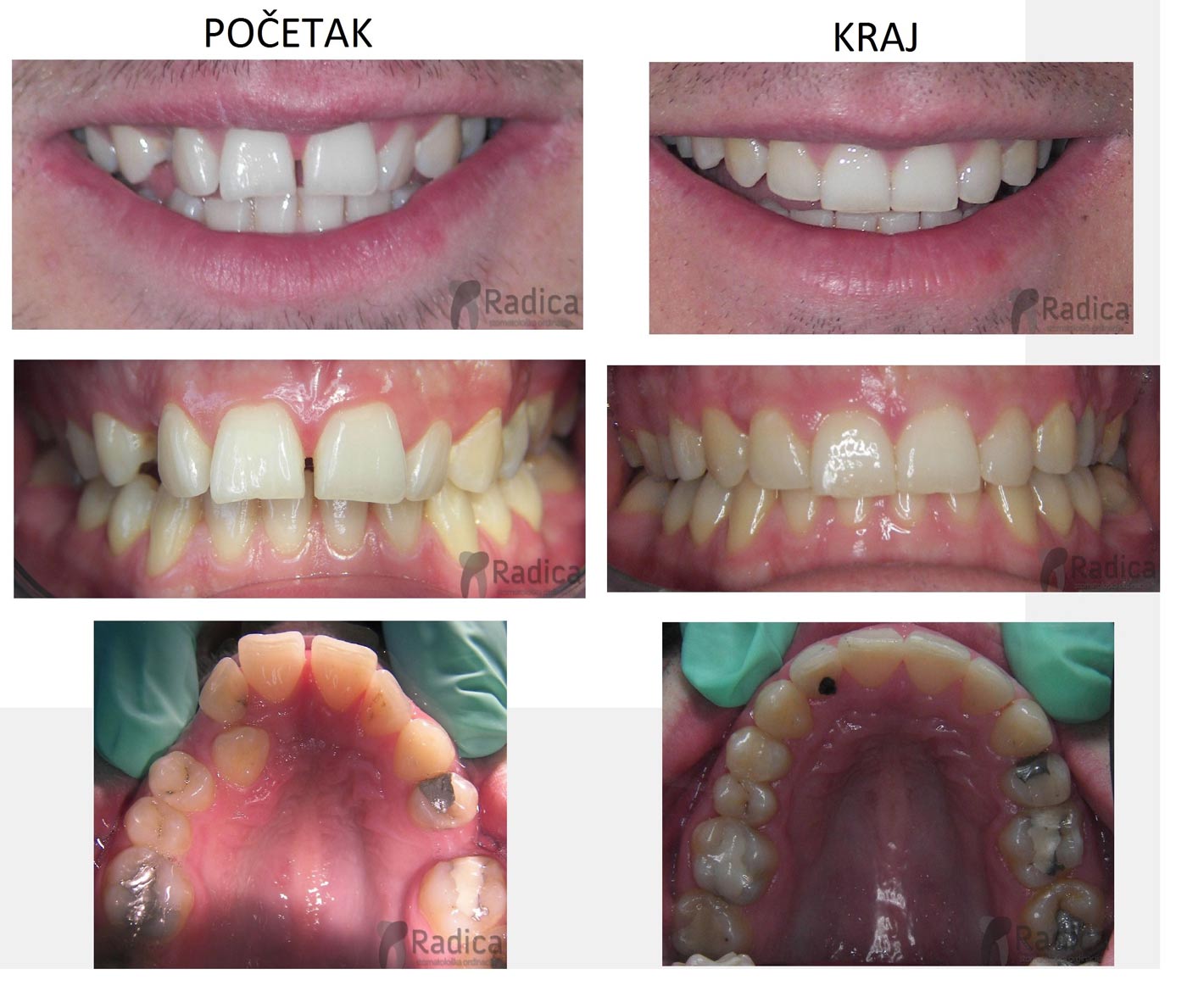 ortodontradicaocnjaknanepcu 1767736266058 374697739