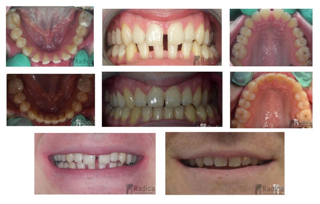 ortodontradicarazmacimedjuzubima 1024x652 1767647584883 780244422