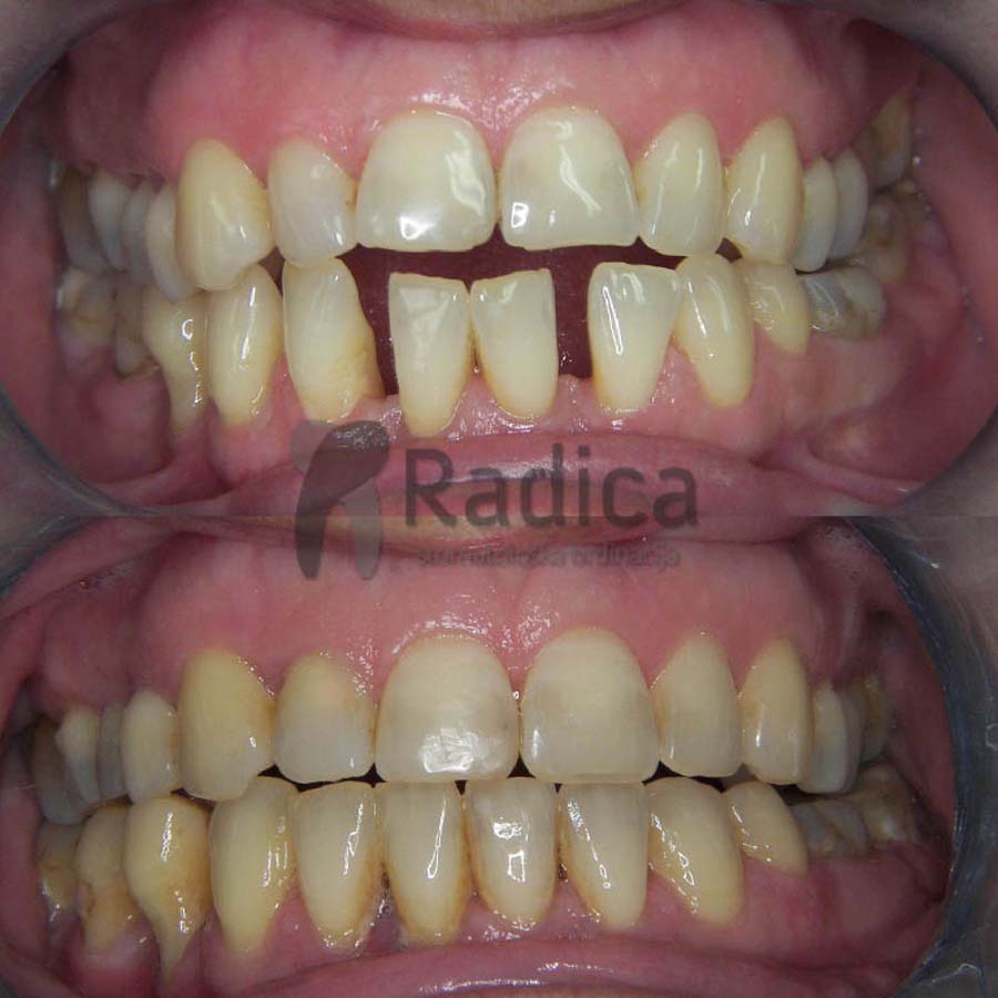 ortodontska terapija odrasli ortodont radica split 0 1770205414043 340588848