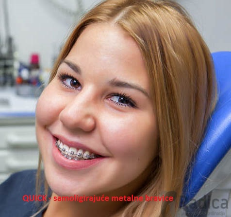 ortodontski aparatic Quick samoligirajui metalni 1770206002486 908592636