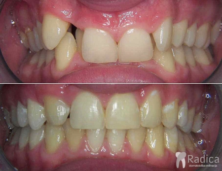 thumbsduboki zagriz hypodontia 1767737303098 185181393