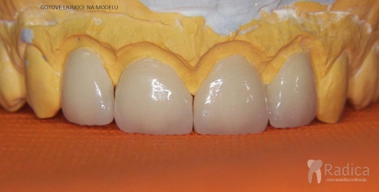 thumbsljuskice model 2 1767898368854 469637817