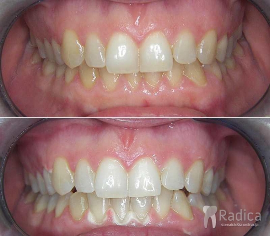 thumbsstomatologija laser terapija 3 1767898238085 884863549