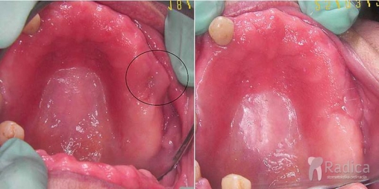 thumbsstomatologija laser terapija 5 1767898025358 791485217